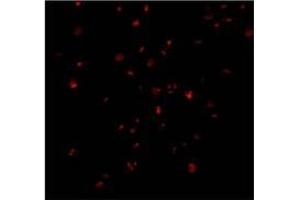 Immunofluorescence of IRE1p in A20 cells with AP30444PU-N IRE1p antibody at 2 ug/ml.