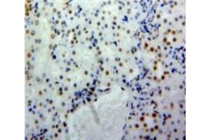 Used in DAB staining on fromalin fixed paraffin-embedded Kidney tissue (SLC9A3R2 Antikörper  (AA 56-326))