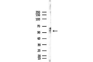 anti-Tetratricopeptide Repeat Domain 23 (TTC23) (Internal Region) antibody