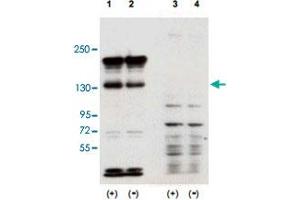 Western blot using Sipa1 polyclonal antibody  shows detection of over-expressed Sipa1 in lysates from mouse NIH/3T3 cells transfected with Sipa1 (Lane 1). (SIPA1 Antikörper  (N-Term))