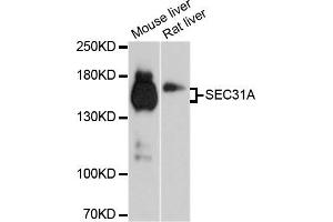 Western blot analysis of extracts of mouse liver and rat liver cell lines, using SEC31A antibody. (SEC31A Antikörper)