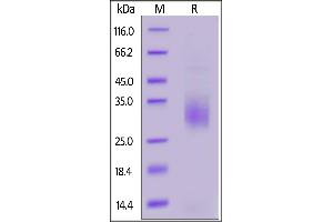 SDS-PAGE (SDS) image for Triggering Receptor Expressed On Myeloid Cells 2 (TREM2) (AA 19-174) (Active) protein (His tag) (ABIN7013655)