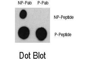 Image no. 1 for anti-Activating Transcription Factor 2 (ATF2) (pSer322) antibody (ABIN358324) (ATF2 Antikörper  (pSer322))