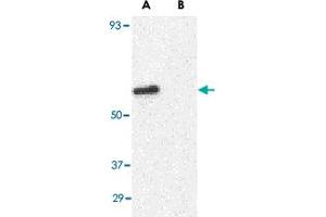 Western blot analysis of GPR44 in Jurkat cell lysate with GPR44 polyclonal antibody  at 1 ug/mL in (A) the absence and (B) presence of blocking peptide. (Prostaglandin D2 Receptor 2 (PTGDR2) (N-Term) Antikörper)
