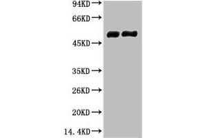 Western blot analysis of 1) Mouse Brain tissue, 2) Rat Brain tissue, diluted at 1:100000. (TUBB2A Antikörper)