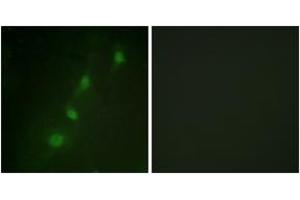 Immunofluorescence analysis of HeLa cells, using SGK (Ab-78) Antibody. (SGK1 Antikörper  (AA 41-90))