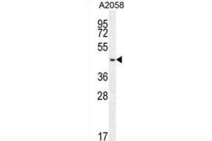 Western Blotting (WB) image for anti-DDB1 and CUL4 Associated Factor 4-Like 2 (DCAF4L2) antibody (ABIN2995734) (DCAF4L2 Antikörper)