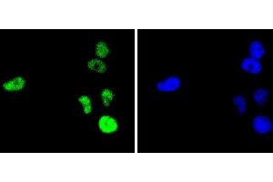 HeLa cells were fixed in paraformaldehyde, permeabilized with 0. (C-JUN Antikörper)