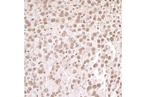 Immunohistochemistry (IHC) image for anti-Protein Arginine Methyltransferase 1 (PRMT1) (AA 1-50) antibody (ABIN7453933) (PRMT1 Antikörper  (AA 1-50))