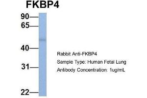 Host:  Rabbit  Target Name:  FKBP4  Sample Type:  Human Fetal Lung  Antibody Dilution:  1. (FKBP4 Antikörper  (C-Term))
