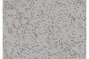 ABIN6257812 and ABIN6273635 at 1/100 staining Rat kidney tissue by IHC-P. (HSPB3 Antikörper  (Internal Region))