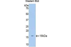 Western blot analysis of the recombinant protein. (Aggrecan Antikörper  (AA 34-147))