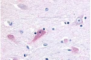 Anti-ROR Beta antibody  ABIN1049295 IHC staining of human brain, thalamus.