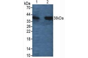Figure. (Cathepsin L Antikörper  (AA 114-288))