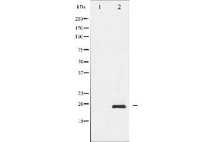 Western blot analysis of Survivin phosphorylation expression in A549 whole cell lysates,The lane on the left is treated with the antigen-specific peptide. (Survivin Antikörper  (pThr117))