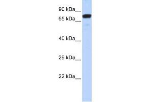 WB Suggested Anti-ZNF221 Antibody Titration:  0.
