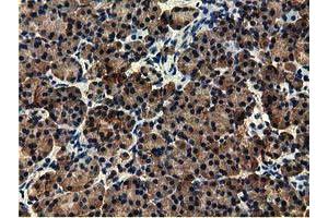 Immunohistochemical staining of paraffin-embedded Human Kidney tissue using anti-EPHX2 mouse monoclonal antibody. (EPHX2 Antikörper)
