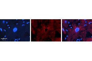 Rabbit Anti-MBD2 Antibody   Formalin Fixed Paraffin Embedded Tissue: Human heart Tissue Observed Staining: Nucleus Primary Antibody Concentration: 1:100 Other Working Concentrations: N/A Secondary Antibody: Donkey anti-Rabbit-Cy3 Secondary Antibody Concentration: 1:200 Magnification: 20X Exposure Time: 0. (MBD2 Antikörper  (Middle Region))