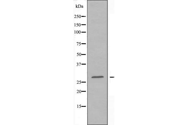 SIX Homeobox 6 Antikörper  (Internal Region)