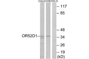 Western blot analysis of extracts from COLO cells and COS cells, using OR52D1 antibody. (OR52D1 Antikörper  (C-Term))