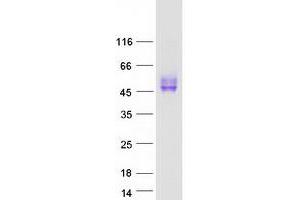 Validation with Western Blot