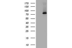 Image no. 1 for anti-RAS Guanyl Releasing Protein 3 (Calcium and DAG-Regulated) (RASGRP3) (AA 380-690) antibody (ABIN1491477) (RASGRP3 Antikörper  (AA 380-690))