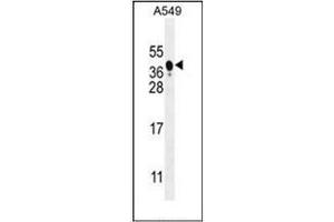 Western blot analysis of BNIP3L / BNIP3A Antibody (Center) in A549 cell line lysates (35ug/lane).