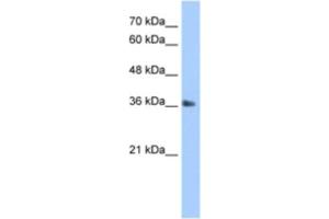 Western Blotting (WB) image for anti-TIMELESS Interacting Protein (TIPIN) antibody (ABIN2463351)