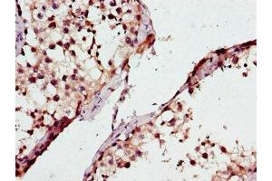 Immunohistochemistry of paraffin-embedded human testis tissue using ABIN7163370 at dilution of 1:100 (ATP8A2 Antikörper  (AA 358-570))