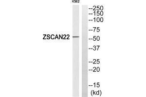 Western blot analysis of extracts from K562 cells, using ZSCAN22 antibody. (ZSCAN22 Antikörper  (Internal Region))
