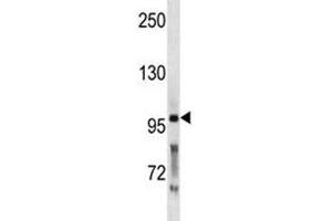 PCSK5 antibody western blot analysis in WiDr lysate. (PCSK5 Antikörper  (AA 95-124))