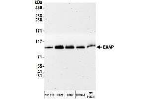 Western Blotting (WB) image for anti-Ubiquitin Protein Ligase E3A (ube3a) (AA 400-450) antibody (ABIN7449675) (ube3a Antikörper  (AA 400-450))