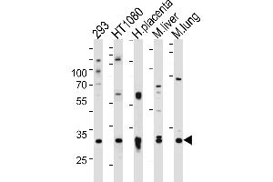 Western blot analysis of lysates from 293,H cell line,human placenta,mouse liver and lung tissue (from left to right),using SAR1A Antibody (Center) (ABIN390902 and ABIN2841109).