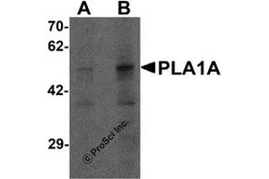 Western Blotting (WB) image for anti-Phospholipase A1 Member A (PLA1A) (C-Term) antibody (ABIN1077384) (PLA1A Antikörper  (C-Term))