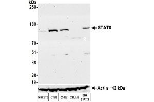 Western Blotting (WB) image for anti-Signal Transducer and Activator of Transcription 6, Interleukin-4 Induced (STAT6) (AA 600-650) antibody (ABIN7453987)