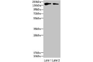 Western blot All lanes: FYCO1 antibody at 2. (FYCO1 Antikörper  (AA 2-255))