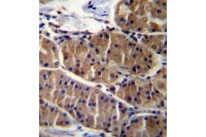 Immunohistochemistry (Paraffin-embedded Sections) (IHC (p)) image for anti-Leucine Rich Repeat and Sterile alpha Motif Containing 1 (LRSAM1) (AA 1-30), (N-Term) antibody (ABIN953239)