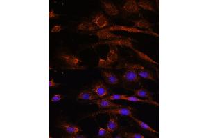 Immunofluorescence analysis of C6 cells using S2 antibody (ABIN7265451) at dilution of 1:100. (AP3S2 Antikörper  (AA 1-193))