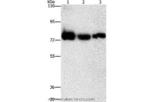Western blot analysis of Human fetal muscle tissue, K562 and hela cell, using AMPD1 Polyclonal Antibody at dilution of 1:1600 (AMPD1 Antikörper)