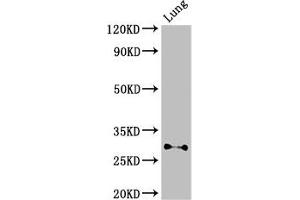 Western Blot Positive WB detected in: Mouse lung tissue All lanes: SPINT2 antibody at 3 μg/mL Secondary Goat polyclonal to rabbit IgG at 1/50000 dilution Predicted band size: 29, 22 kDa Observed band size: 29 kDa