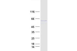 Western Blotting (WB) image for Prolyl 4-Hydroxylase, alpha Polypeptide I (P4HA1) (Transcript Variant 1) protein (Myc-DYKDDDDK Tag) (ABIN2728091)