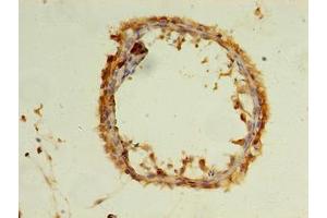 Immunohistochemistry of paraffin-embedded human testis tissue using ABIN7175746 at dilution of 1:100 (WDR37 Antikörper  (AA 1-264))