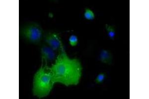 Anti-DYNC1LI1 mouse monoclonal antibody (ABIN2452968) immunofluorescent staining of COS7 cells transiently transfected by pCMV6-ENTRY DYNC1LI1 (RC222010). (DYNC1LI1 Antikörper)
