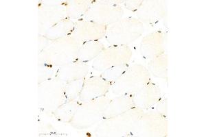 Immunohistochemistry (Paraffin-embedded Sections) (IHC (p)) image for anti-RNA Binding Motif Protein 45 (RBM45) antibody (ABIN7075477)