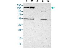 Western blot analysis of Lane 1: RT-4, Lane 2: U-251 MG, Lane 3: Human Plasma, Lane 4: Liver, Lane 5: Tonsil with JMJD2A polyclonal antibody  at 1:250-1:500 dilution. (KDM4A Antikörper)