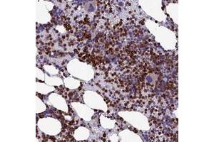 Immunohistochemical staining of human bone marrow with C19orf48 polyclonal antibody  shows strong cytoplasmic positivity in hematopoietic cells. (C19orf48 Antikörper)