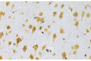 Immunohistochemistry of paraffin-embedded Mouse brain using MDM2 Polyclonal Antibody at dilution of 1:200 (40x lens). (MDM2 Antikörper)