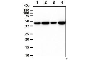 The cell lysates (40ug) were resolved by SDS-PAGE, transferred to PVDF membrane and probed with anti-human CKB antibody (1:1000).