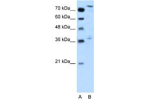 WB Suggested Anti-NFE2L3 Antibody Titration:  0. (NFE2L3 Antikörper  (Middle Region))