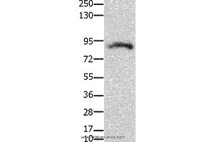 Western blot analysis of Mouse brain tissue, using KCNH2  Polyclonal Antibody at dilution of 1:100 (KCNH2 Antikörper)